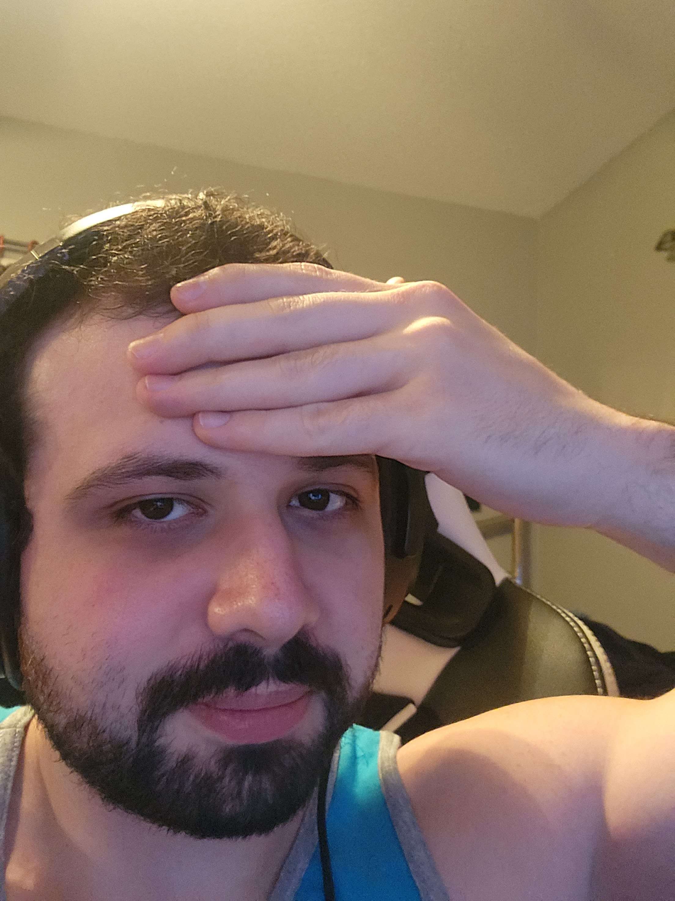 Hairline